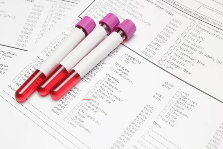 Blood test samples used to detect health conditions through laboratory screening in Singapore